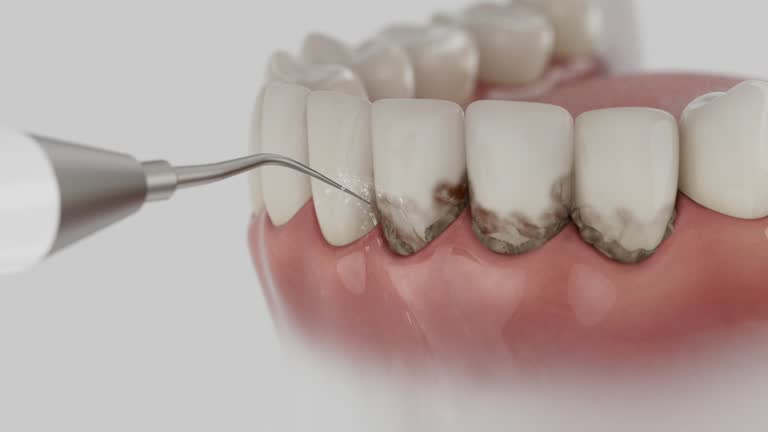 Reliable Root Canal Treatment contractor in Dakota County County, MN by Dentist Open Now